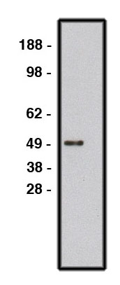 "
Western blot using ROBO1 antibody (Cat. No. X2334P) on human brain lysate (Cat. No. X1633C).  Lysate used at 15 µg/lane.    Antibody used at 10 µg/ml.  Secondary antibody, mouse anti-rabbit HRP (Cat. No. X1207M), used at 1:50k."